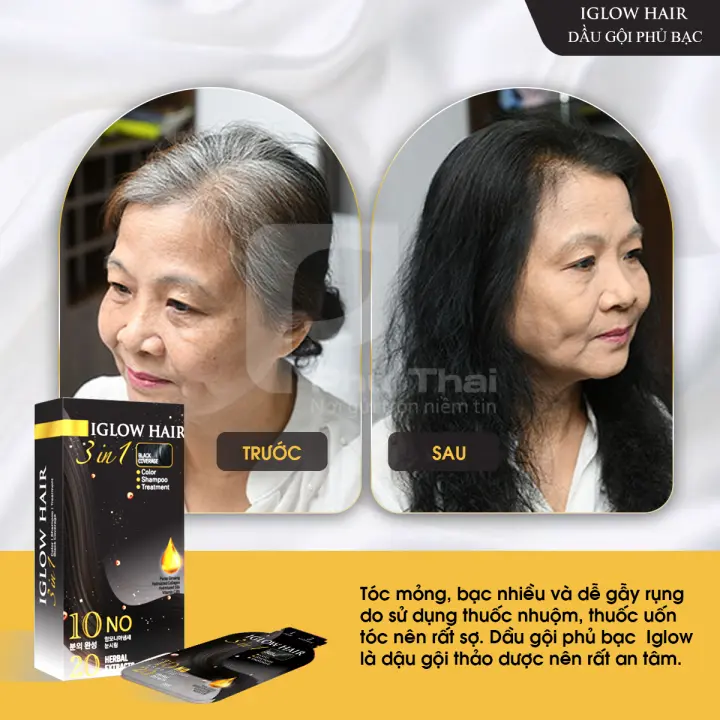 feedback iglow hair - review iglow hair - iglow hair có tốt không - iglow hair có hiệu quả không - 1shop.com.vn - 11