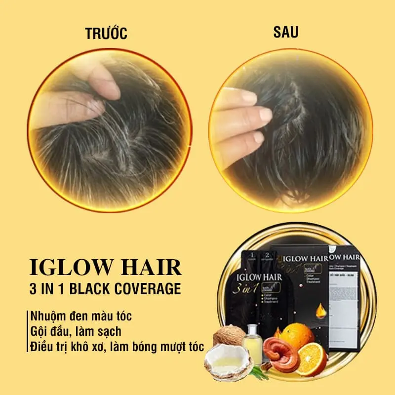 feedback iglow hair - review iglow hair - iglow hair có tốt không - iglow hair có hiệu quả không - 1shop.com.vn - 2