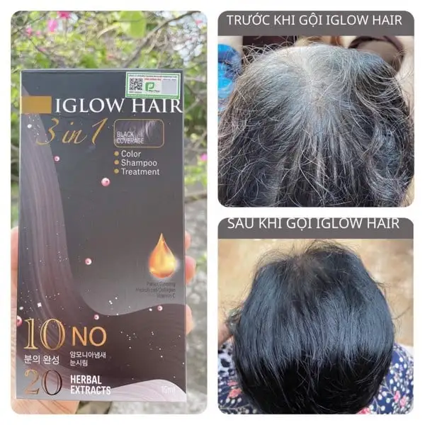 feedback iglow hair - review iglow hair - iglow hair có tốt không - iglow hair có hiệu quả không - 1shop.com.vn - 3