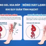 Gel Lạnh Xoa Bóp Giảm đau Abena Activ Gel 250ml - Đroppii Mall (3)