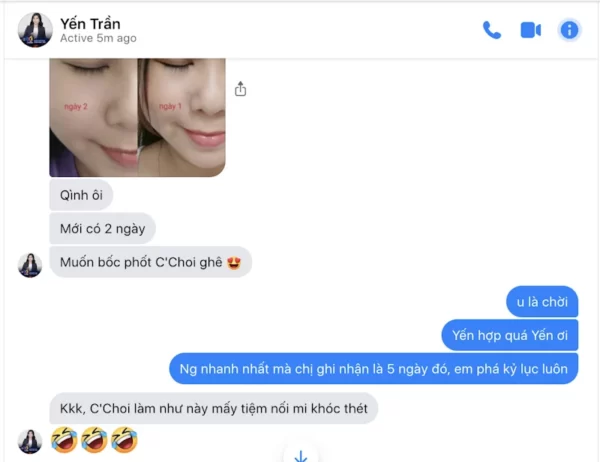 Review Dưỡng Mi Tế Bào Gốc C'choi - Bio-placenta Lash Serum - Punar - 1Shop.com.vn - Hình 10