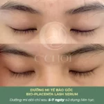 Review Dưỡng Mi Tế Bào Gốc C'choi - Bio-placenta Lash Serum - Punar - 1Shop.com.vn - Hình 13